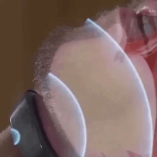 Compact Anti Snore Sleep Device USB Silent