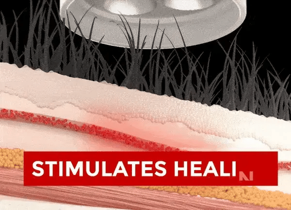 Advanced Red Light Therapy Device for Home Use